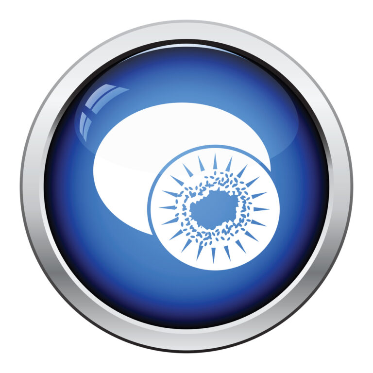 Illustration of an eye and scleral lens used for keratoconus treatment