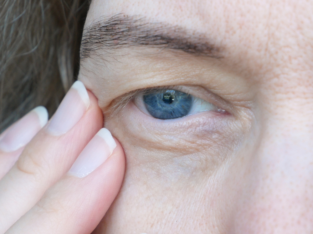 Close-up of a person gently lifting their eyelid, illustrating ptosis symptoms and eye health.